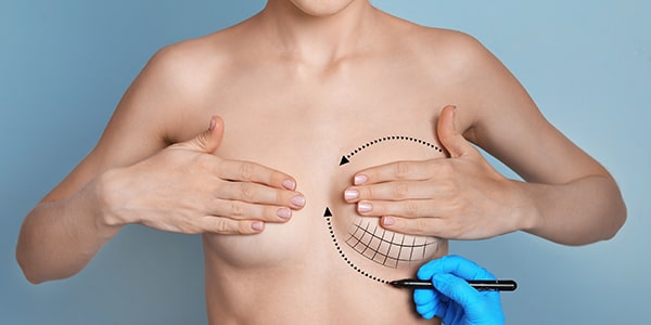 Augmentation mammaire par implants
